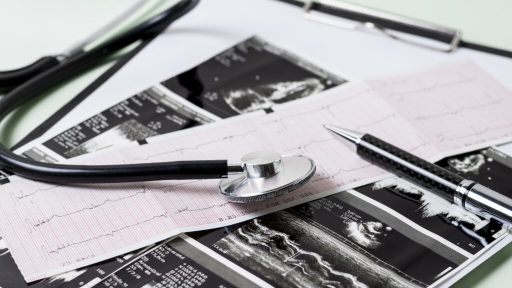 Plannings opératoires sous tension